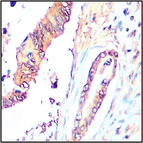 MMP1 antibody MMP1 antibody