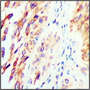 TIMP1 antibody TIMP1 antibody