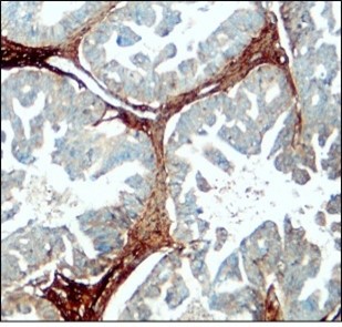 Fibronectin antibody Fibronectin antibody