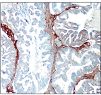 COL1A1 / Collagen I antibody COL1A1 / Collagen I antibody