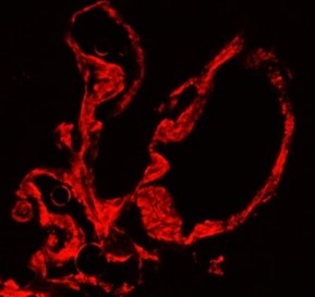 α-Smooth Muscle Actin antibody α-Smooth Muscle Actin antibody