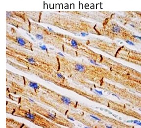 Desmin monolonal antibody Desmin monolonal antibody
