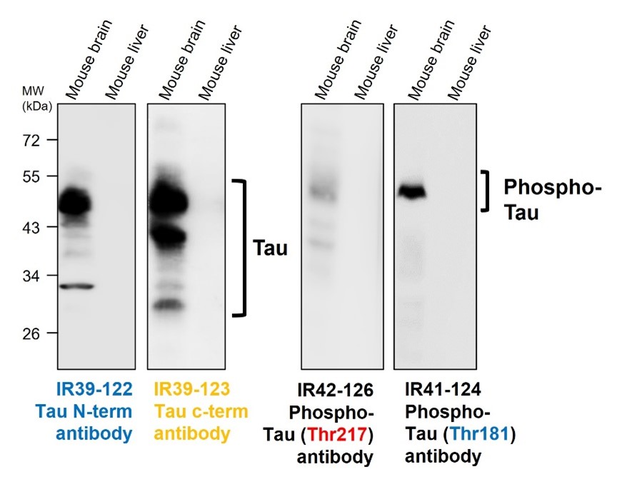 Total-Tau antibody / N-terminal Tau antibody / phospho-Tau181 antibody / phospho-Tau217 antibody Total-Tau antibody / N-terminal Tau antibody / phospho-Tau181 antibody / phospho-Tau217 antibody