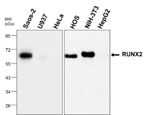 Anti-Rat IgG (H+L) (GOAT) Antibody Peroxidase Conjugated Anti-Rat IgG (H+L) (GOAT) Antibody Peroxidase Conjugated