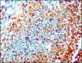 IR252-897 anti-CD3 antibody IHC image