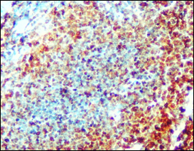 IR252-897 anti-CD3 antibody IHC image IR252-897 anti-CD3 antibody IHC image