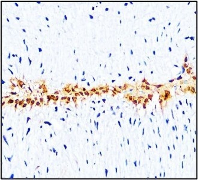 L-selectin_CD62L antibody IHC image