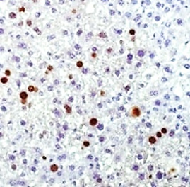 Ki-67 [SP6] Rab-monoclonal