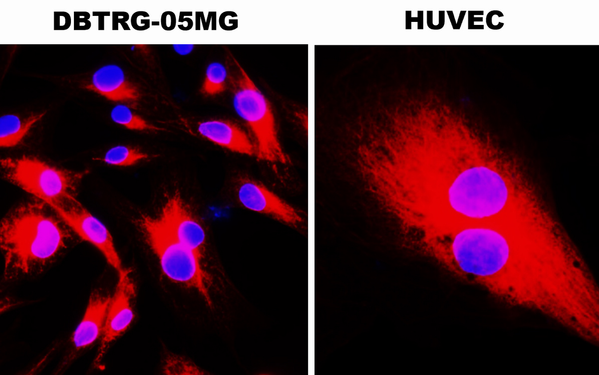 IR1-2 anti-beta Tubulin antibody ICC/IF image