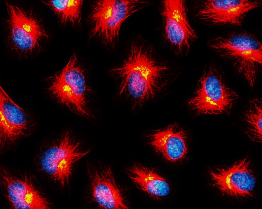 Customer feedback Image IR1-2 anti-beta Tubulin antibody ICC/IF image Customer feedback Image IR1-2 anti-beta Tubulin antibody ICC/IF image
