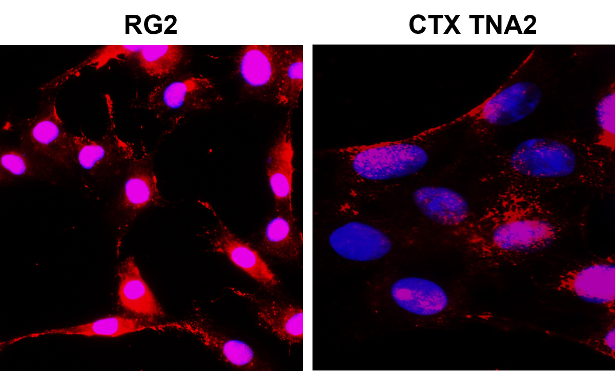 IR7-21 anti-NOTCH1 antibody ICC/IF image IR7-21 anti-NOTCH1 antibody ICC/IF image