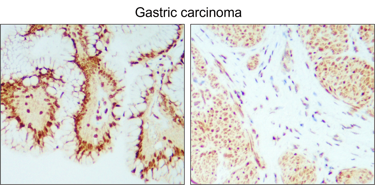 IR101-420 anti-PARP cleaved antibody IHC image