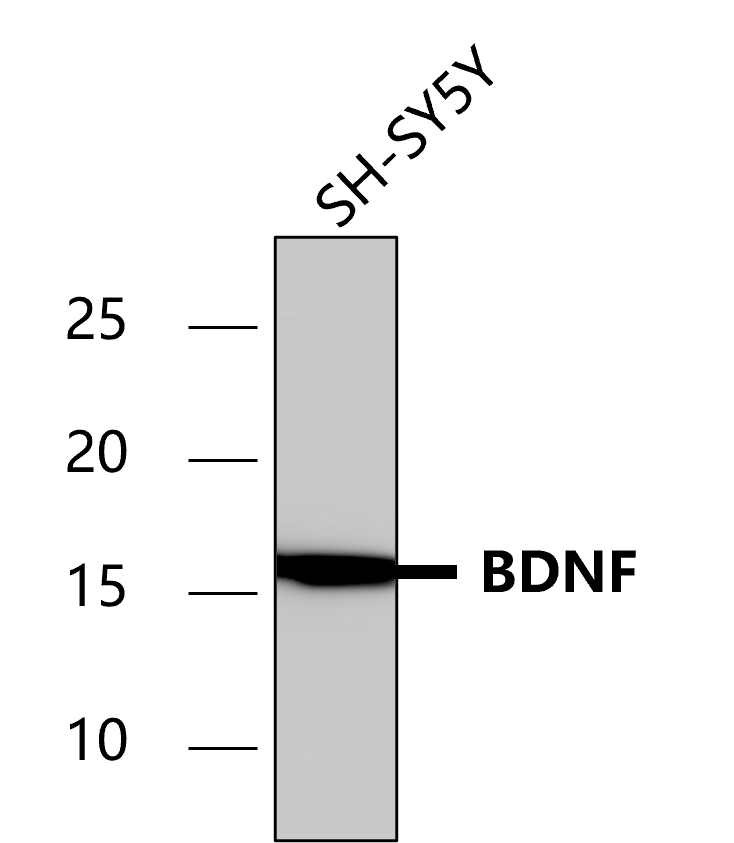IR14-38 anti-BDNF antibody WB image IR14-38 anti-BDNF antibody WB image