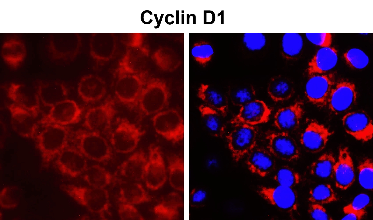 IR117-294 anti-Cyclin D1 antibody ICC/IF image