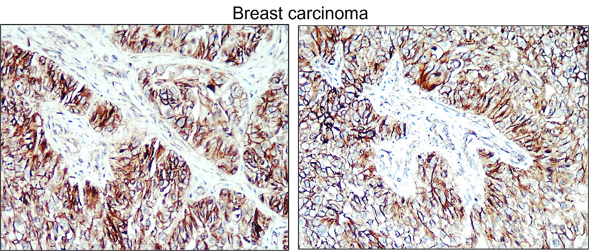 IR117-294 anti-Cyclin D1 antibody IHC image IR117-294 anti-Cyclin D1 antibody IHC image