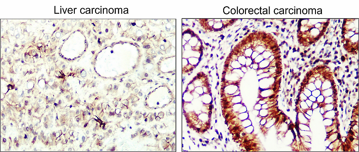 IR117-294 anti-Cyclin D1 antibody IHC image IR117-294 anti-Cyclin D1 antibody IHC image