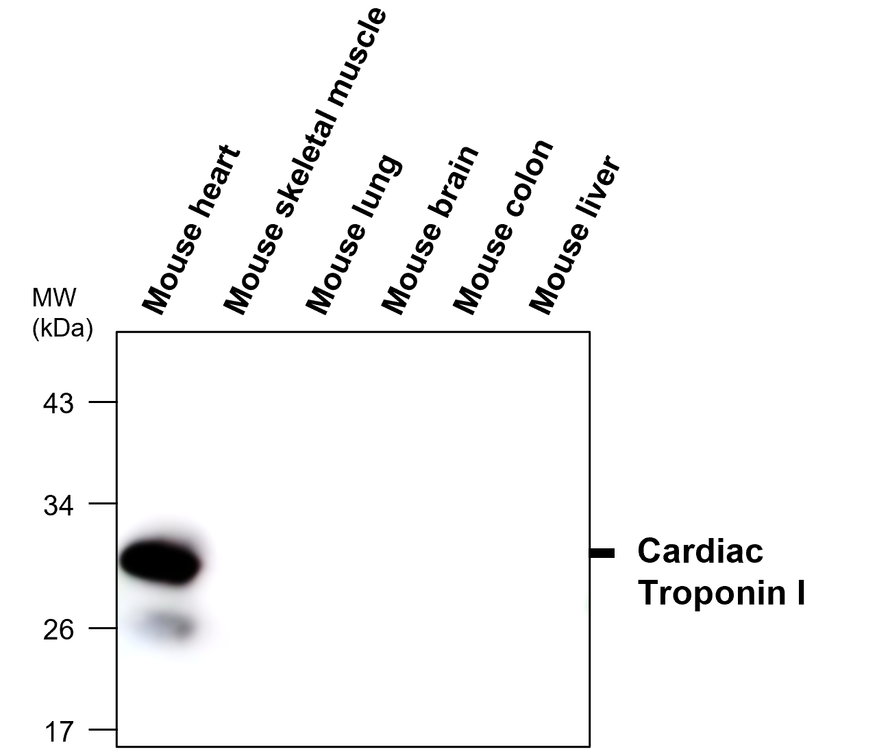 IR294-967 anti-Troponin I, cardiac muscle antibody WB image