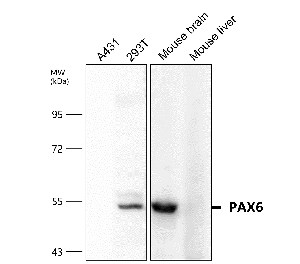 IR6-17 anti-PAX6 antibody WB image IR6-17 anti-PAX6 antibody WB image