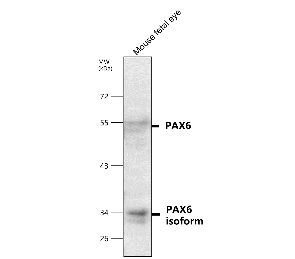 IR6-17 anti-PAX6 antibody WB image IR6-17 anti-PAX6 antibody WB image