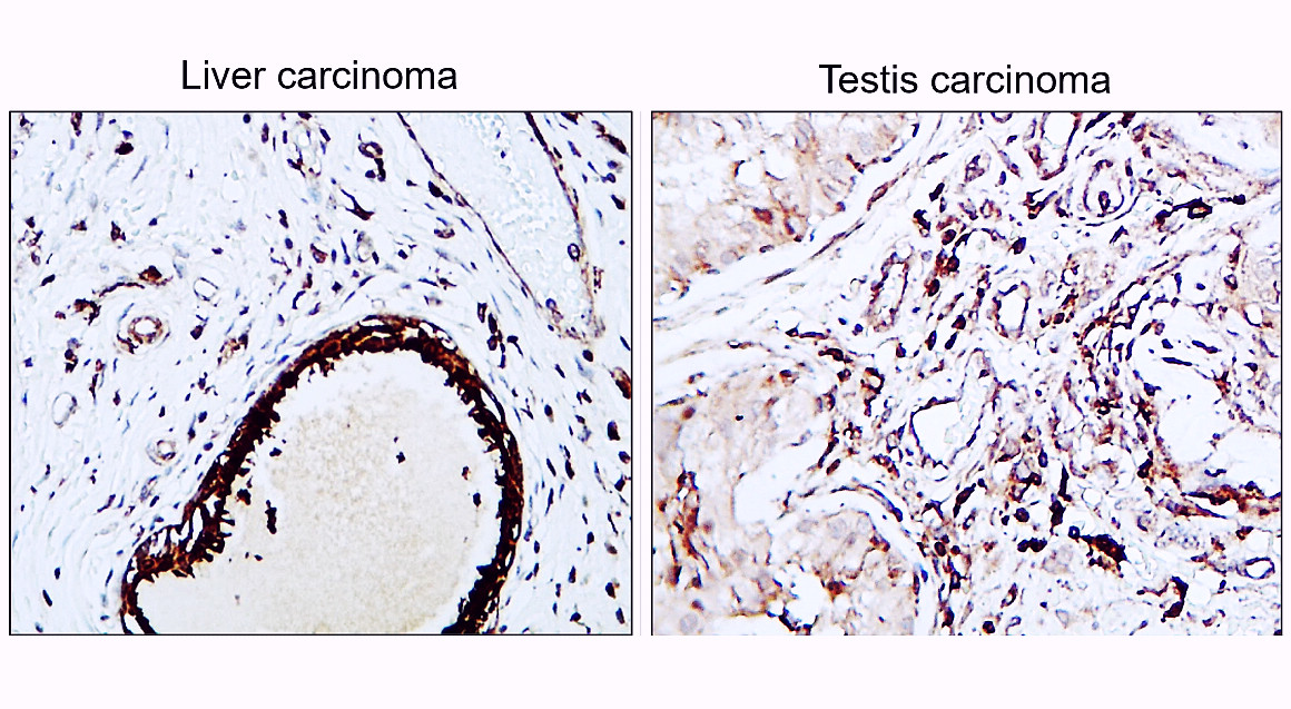 IR108-442 anti-VEGF antibody IHC image