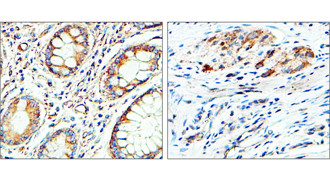 IR8-3 anti-EEA1 antibody IHC image
