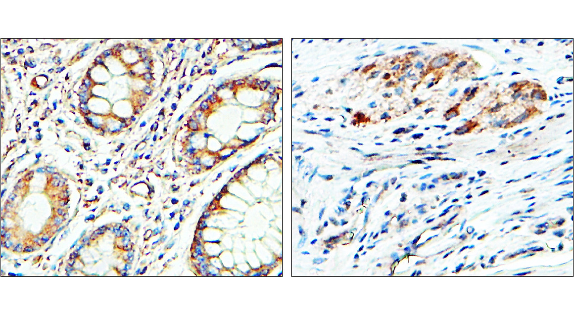 IR8-3 anti-EEA1 antibody IHC image IR8-3 anti-EEA1 antibody IHC image