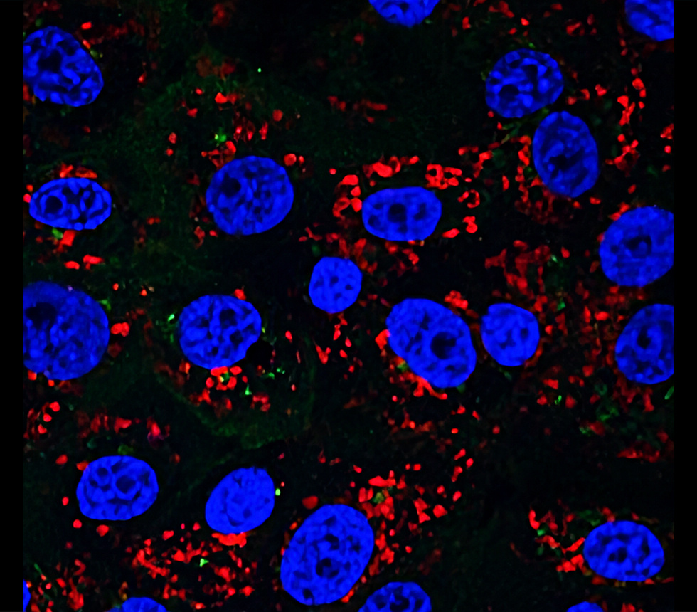 Customer feedback Image IR8-3 anti-EEA1 antibody ICC image