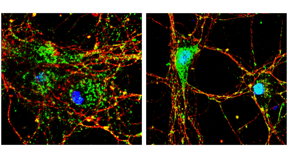 Customer feedback Image IR8-3 anti-EEA1 antibody IF image