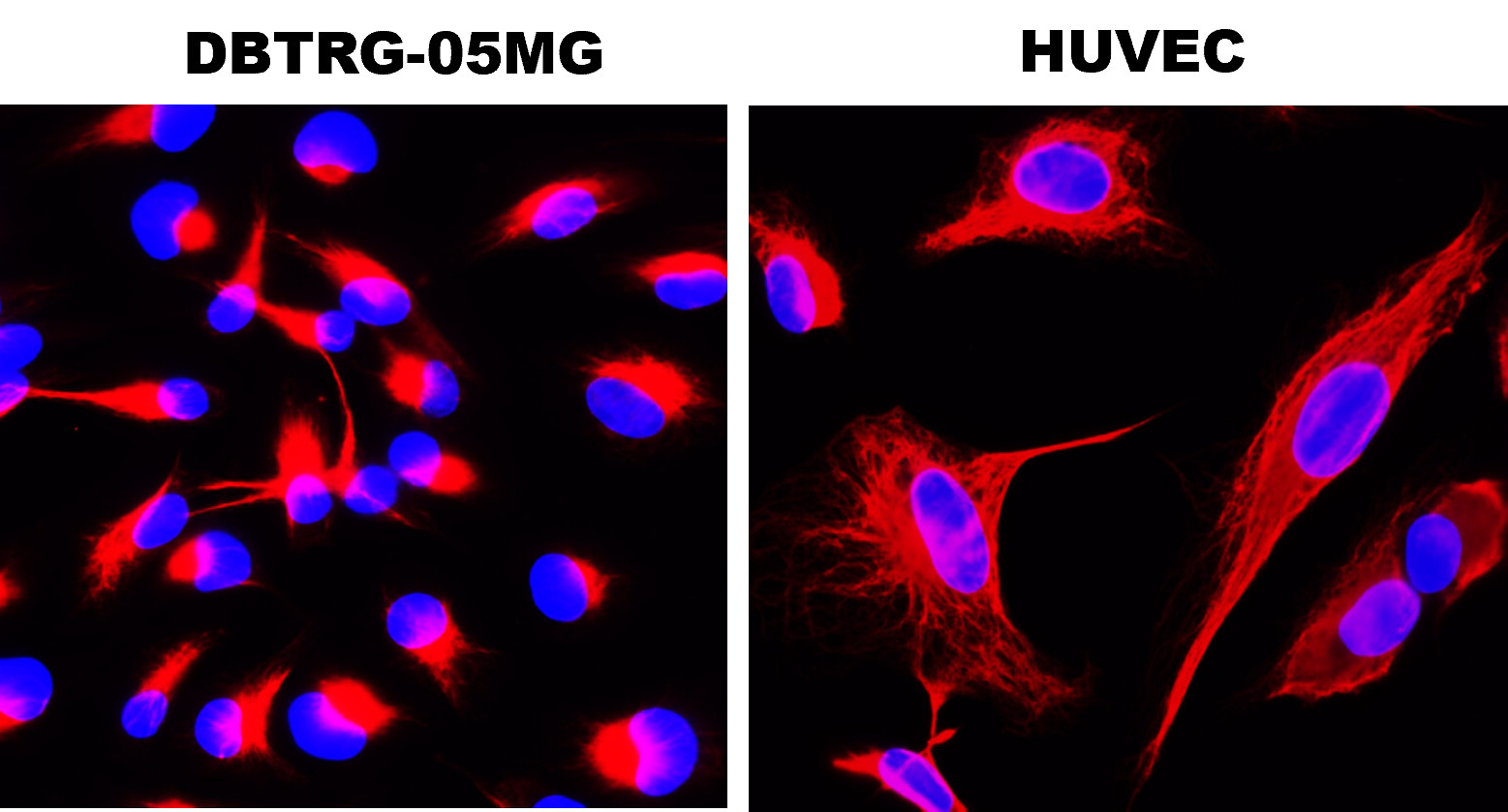 IR1-2-2 anti-Vinculin antibody ICC/IF image