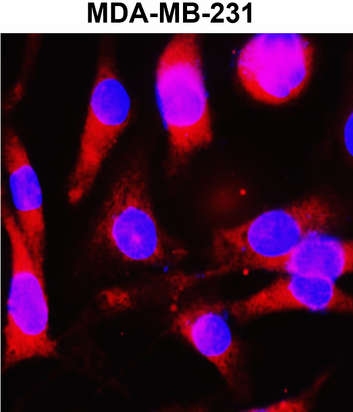 IR2-7 anti-Beta Actin antibody_MDA-MB-231 ICC/IF image