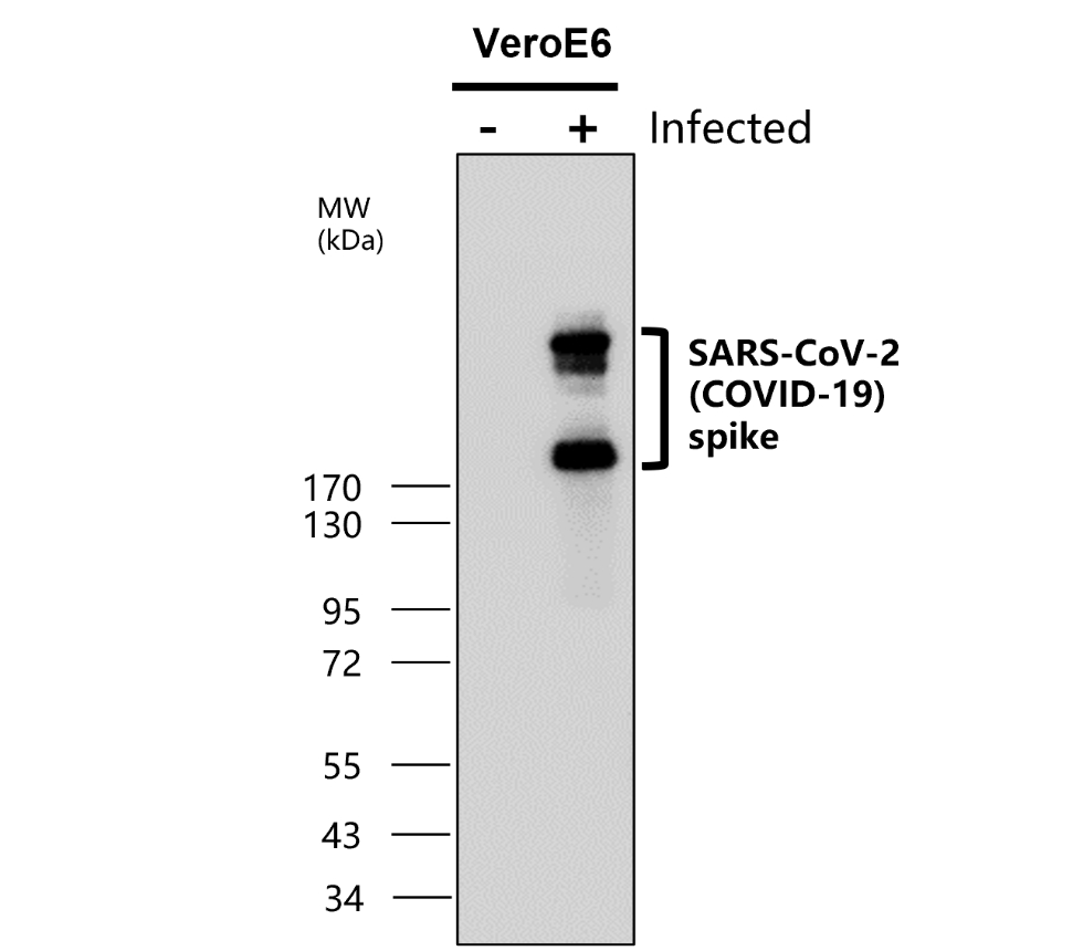 IRST003 anti- SARS-CoV-2 spike protein antibody WB image IRST003 anti- SARS-CoV-2 spike protein antibody WB image