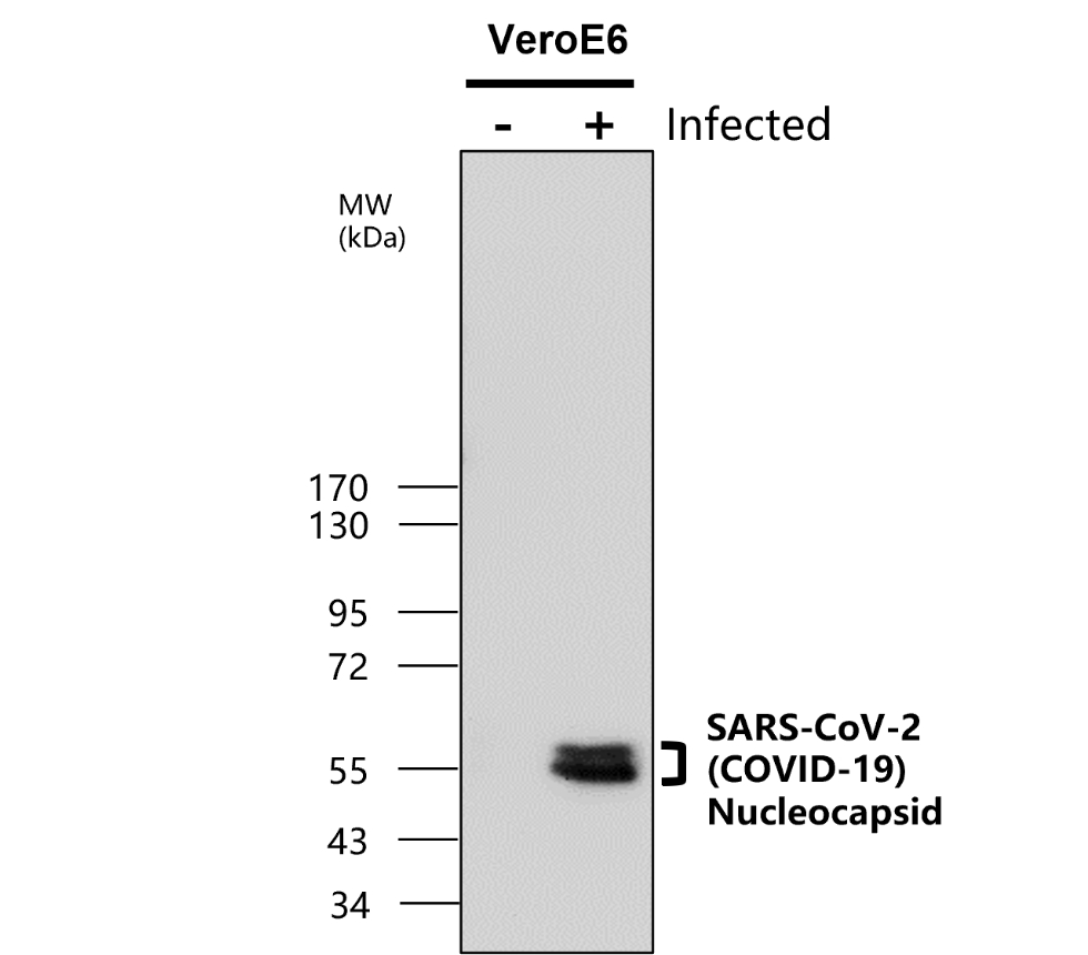 IRCR007 anti- SARS-CoV-2 nucleocapsid protein antibody WB image IRCR007 anti- SARS-CoV-2 nucleocapsid protein antibody WB image