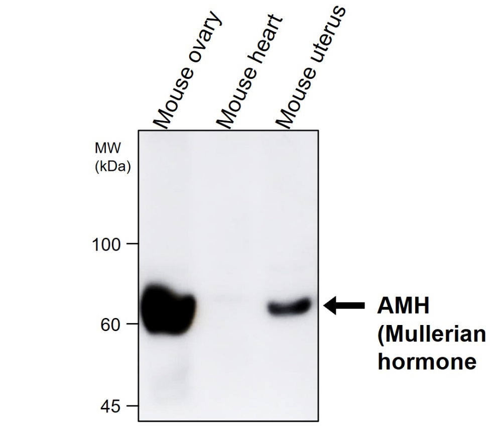 IRCP014 anti-AMH (Mullerian hormone) antibody WB image IRCP014 anti-AMH (Mullerian hormone) antibody WB image