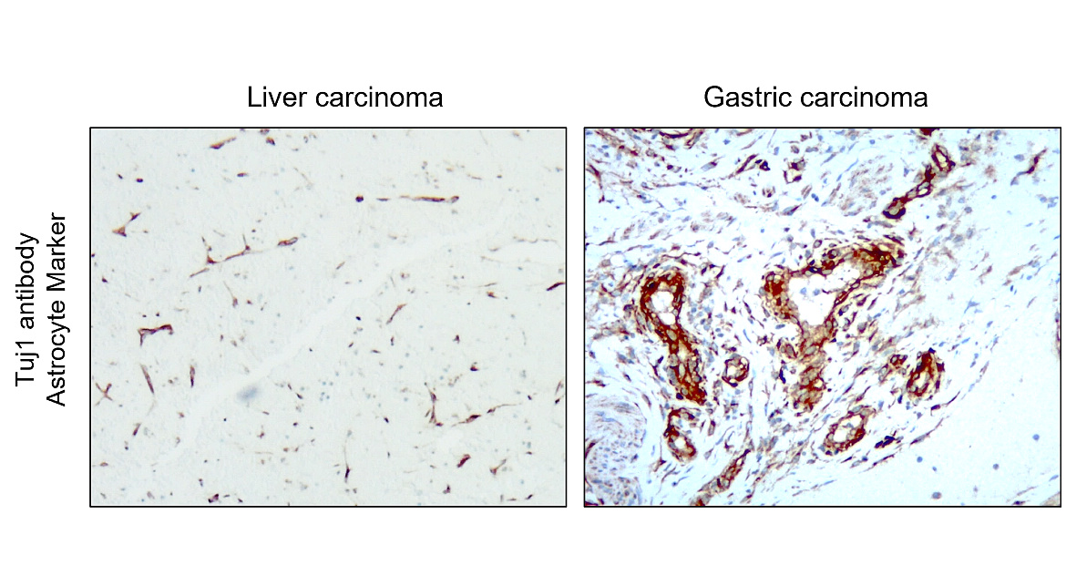 IR11-31 anti- Beta Tubulin 3/ Tuj1 antibody IHC image