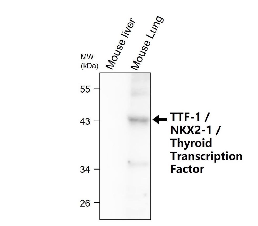 IR350-950 anti-Thyroid Transcription Factor 1 antibody WB image IR350-950 anti-Thyroid Transcription Factor 1 antibody WB image