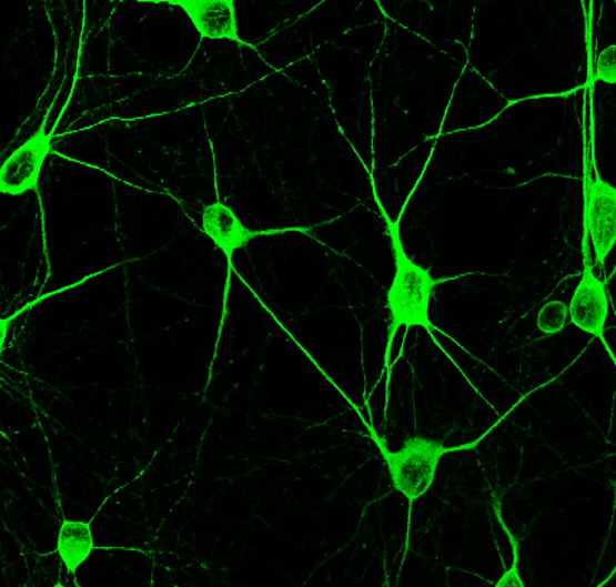 Customer feedback Image IR12-33 anti-MAP2 antibody IF image Customer feedback Image IR12-33 anti-MAP2 antibody IF image