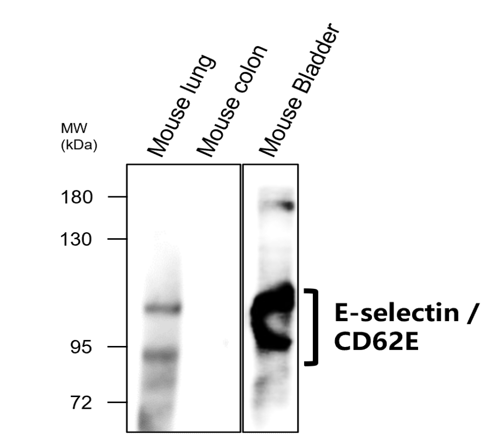 IR308-917 anti E-selectin / CD62E antibody WB image IR308-917 anti E-selectin / CD62E antibody WB image