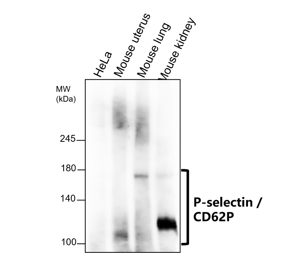 IR307-912 anti P-selectin / CD62P antibody WB image IR307-912 anti P-selectin / CD62P antibody WB image