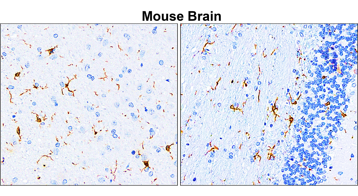 IR13-36 anti-Iba1/AIF1 antibody_Mouse Brain IHC image IR13-36 anti-Iba1/AIF1 antibody_Mouse Brain IHC image