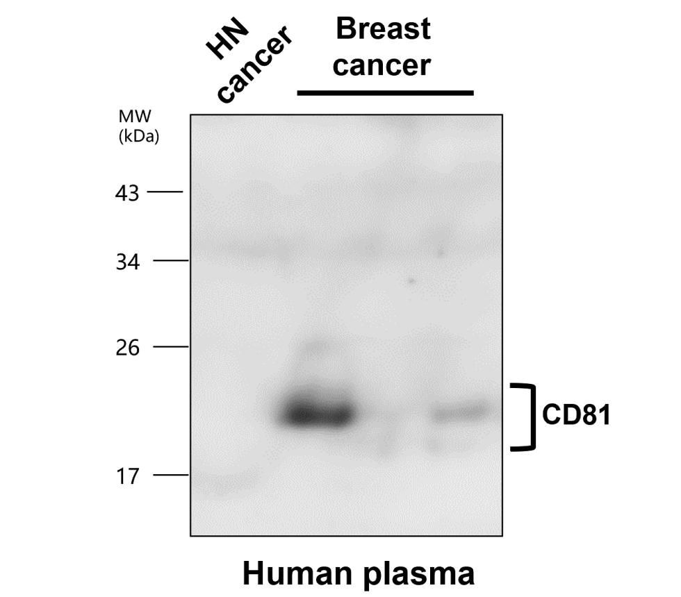 IR302-986 anti-CD81 antibody WB image IR302-986 anti-CD81 antibody WB image