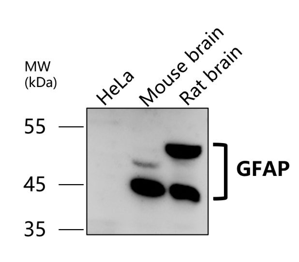 IR15-44 anti-GFAP antibody WB image IR15-44 anti-GFAP antibody WB image