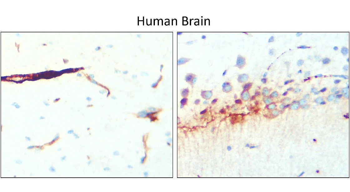 IR15-44 anti-GFAP antibody_Human Brain IHC image IR15-44 anti-GFAP antibody_Human Brain IHC image
