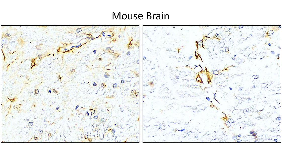 IR15-44 anti-GFAP antibody_Mouse Brain IHC image IR15-44 anti-GFAP antibody_Mouse Brain IHC image
