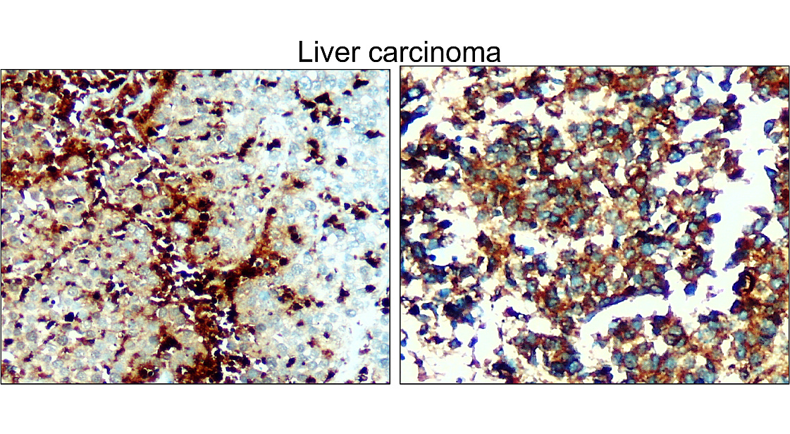 IR16-2 anti-VDAC1 antibody IHC image IR16-2 anti-VDAC1 antibody IHC image