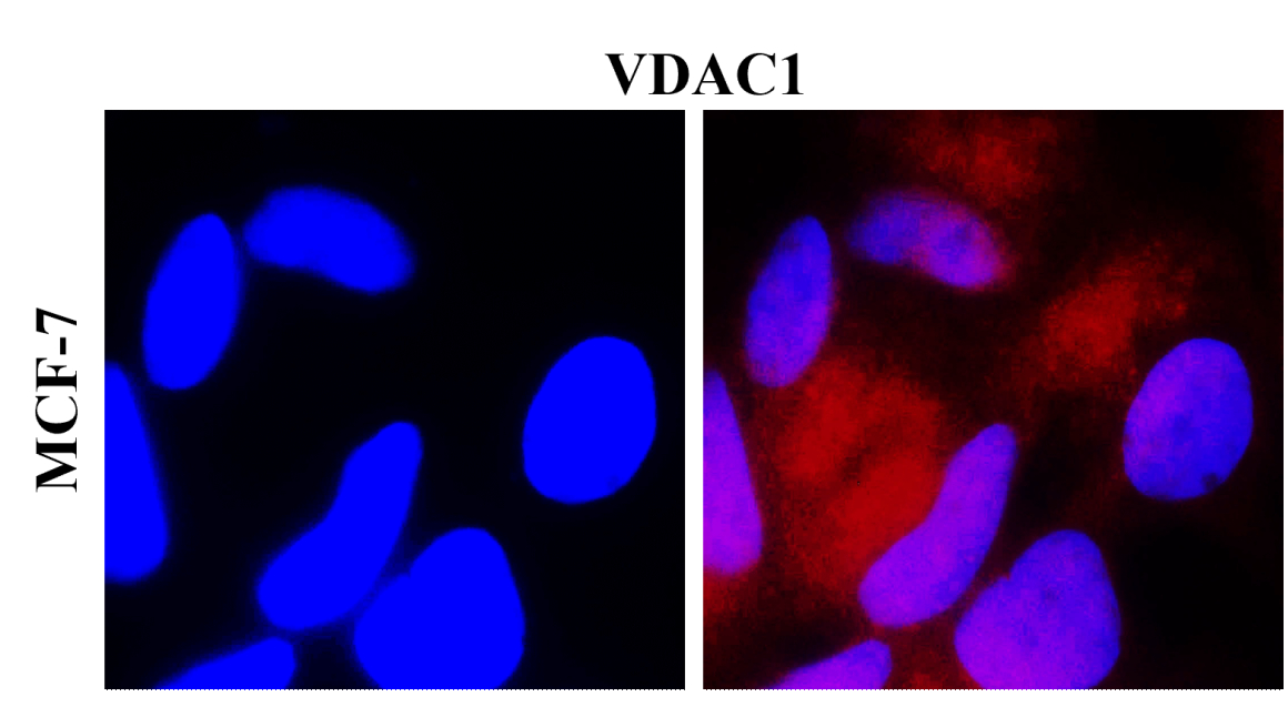 IR16-2 anti-VDAC1 antibody ICC/IF image IR16-2 anti-VDAC1 antibody ICC/IF image