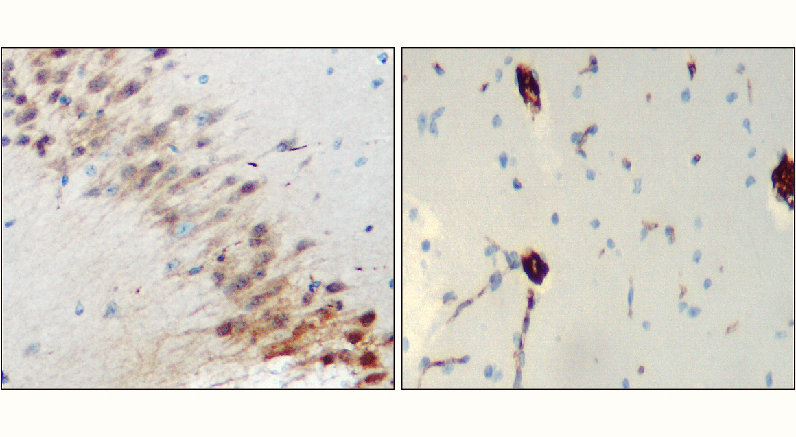 IR23-P1 anti- Neurofilament-L / NF-L antibody IHC image