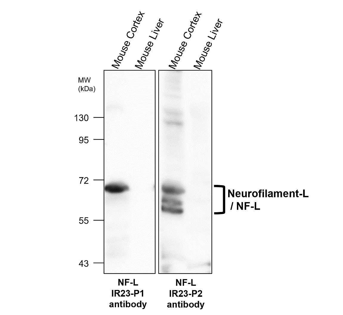 IR23-P2 anti- Neurofilament-L / NF-L antibody WB image