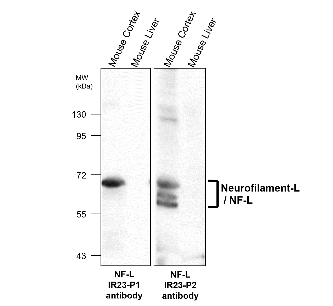 IR23-P2 anti- Neurofilament-L / NF-L antibody WB image IR23-P2 anti- Neurofilament-L / NF-L antibody WB image