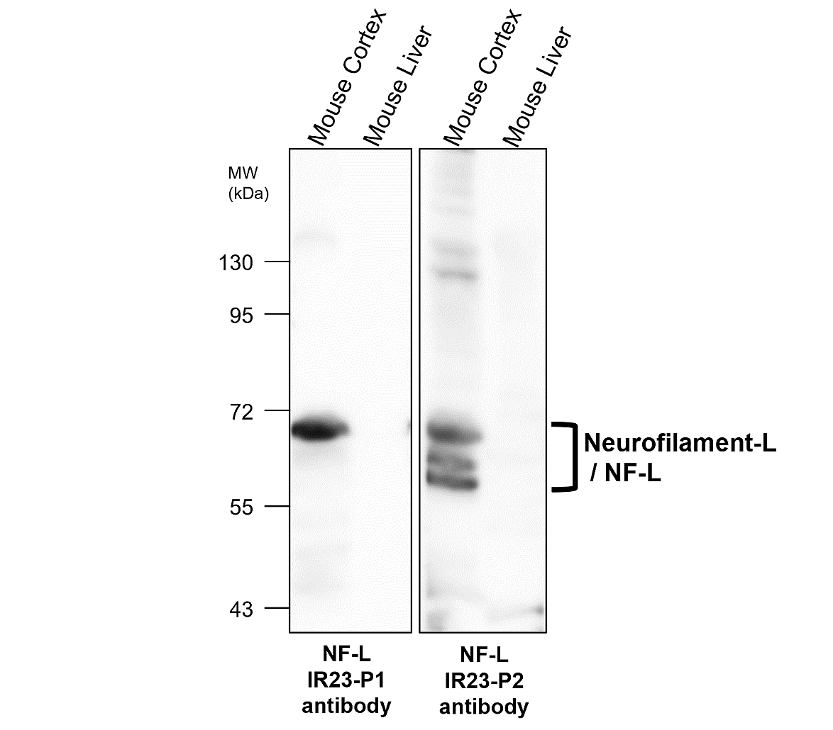 IR23-P1 anti- Neurofilament-L / NF-L antibody WB image