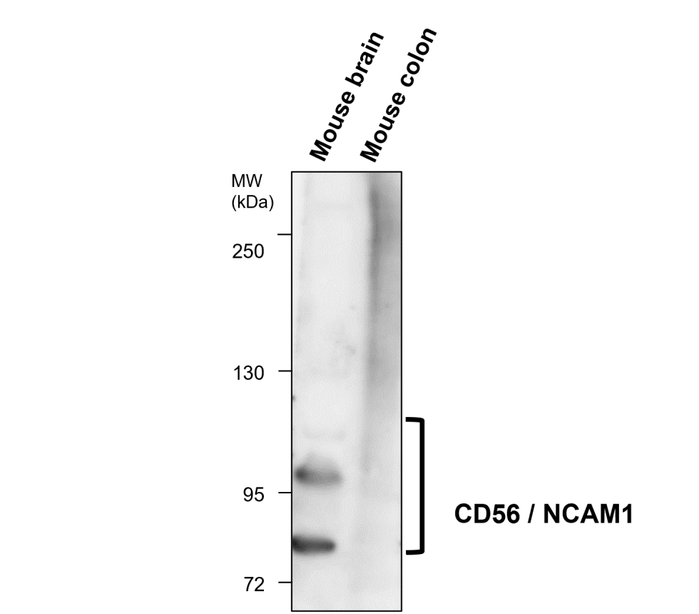 IR255-907 anti-CD56 antibody WB image IR255-907 anti-CD56 antibody WB image